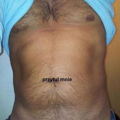 kto mnie przytuli